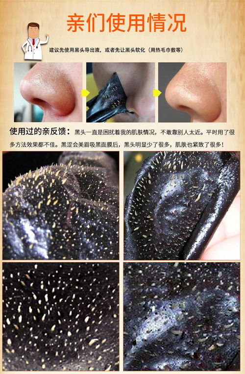 竹炭吸黑头面膜对皮肤有害吗