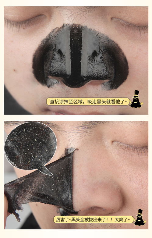 竹炭面膜真的可以吸黑头吗