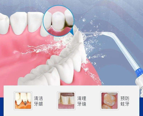 活性炭牙膏真的可以让牙齿变白吗