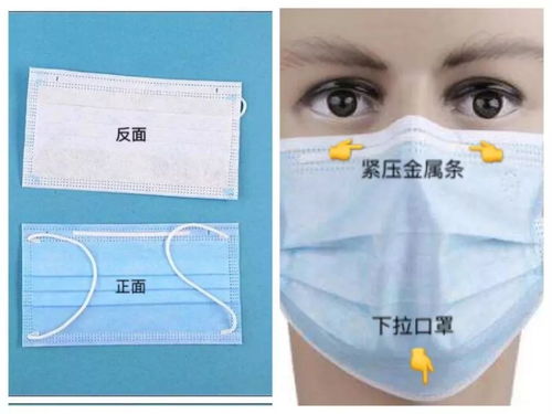 医用活性炭口罩戴法